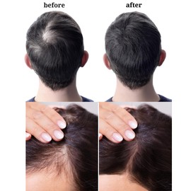 Infinix Jamaican WILD Black Rice Bran Oil with Tea Tree | Super Power Hair Growth Oil – Natural & Nourishing Formula | Face, Body & Hair | Thicker, Fuller Hair | 2 Fl Oz Each (Pack of 3 (2 Fl Oz))