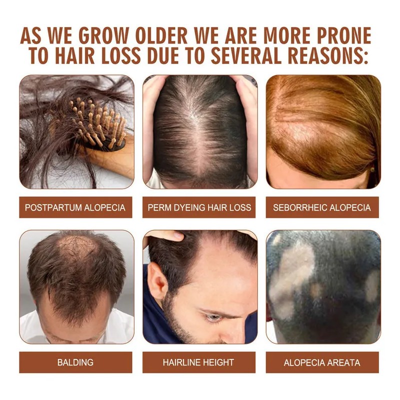 120 Ml Aceite De Crecimiento Del Cabello De Aceite De