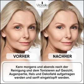 Vitavelle Snail Slime Concentrate Serum - Face Care Against Wrinkles & Hyperpigmentation - Anti Pimple Anti Wrinkle Face Cream for All Skin Types - Anti-Ageing Day Cream with Snail Mucin