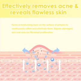 30ml Face Serum Face Serum with Anti-Pimple & Moisturiser for Clear, Balanced Skin, Gentle Care for Pure Skin