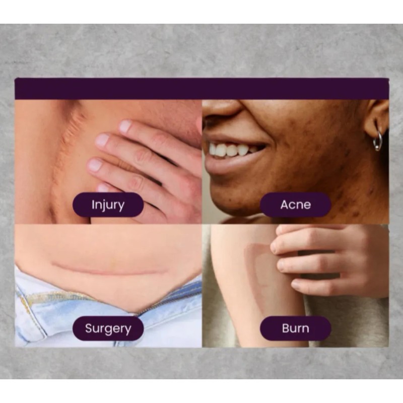 Mederma Gel Proactivo Reductor De Cicatrices 2pack 20g C/u Todo