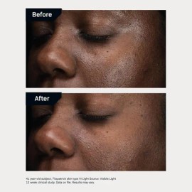 Revision Skincare D·e·j Daily Boosting Serum, Suero Antienve
