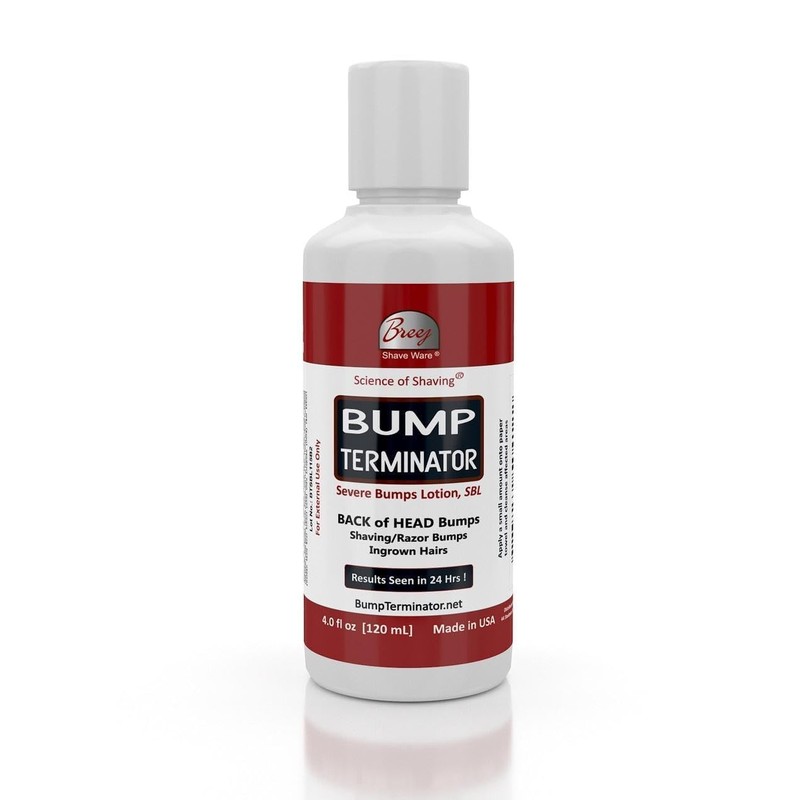 BUMP TERMINATOR Severe Bumps Treatment | Razor Bumps And Ingrown