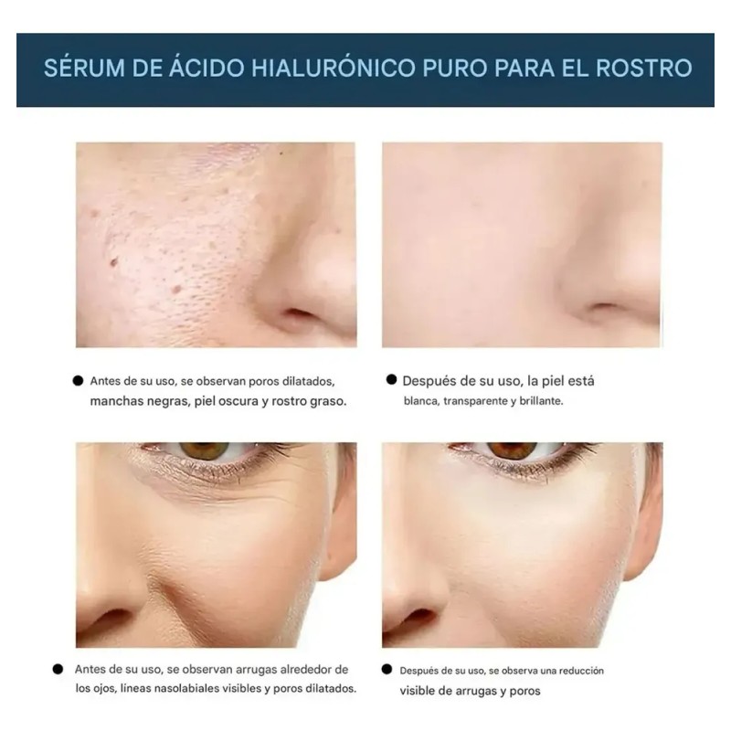 Hilos de Colágeno LUJITO para Rejuvenecer e Hidratar Piel, 60