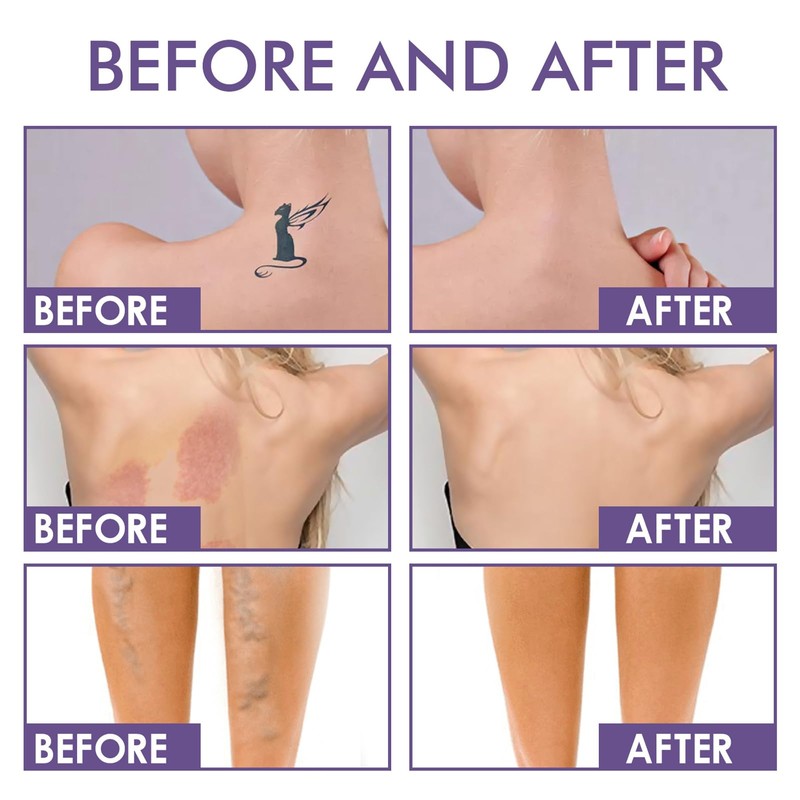 All Over Complexion Perfector - Body Coverage Perfector Waterproof -
