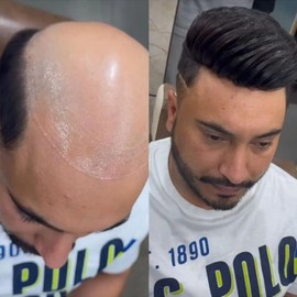 Super Natural Hairline Human Hair Mens Toupee Free Style 10x8 inch Thin Skin Hairpieces Replacement Systems Men Hair (0.06mm skin, #1，jet black)