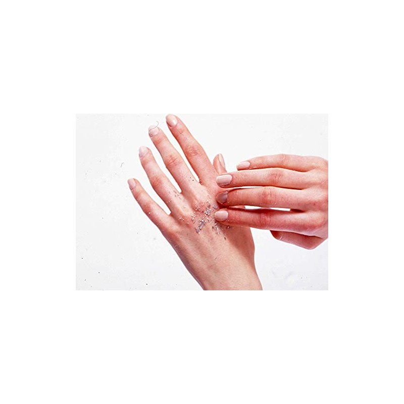 Tommy Rich Akasuri Agassi