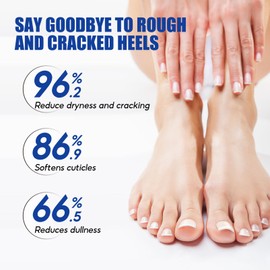 DMQ 60% Urea Cream, Foot Cream for Cracked Heels and Dry Skin, Urea Hand Foot Cream for Dry Cracked Deep Moisturizing, Callus Remover Nourishes Soften For Feet, Knees, Hand