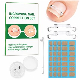Toenail Correction Set, Straight & Curved Nail Clips for Ingrown Toenails, Reusable Nail Repair Splints, Pedicure Nail Set for Home