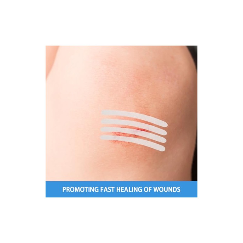Pack of 32 Wound Fastening Strips 2 Sizes Wound Closure