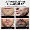 2xcontiene De Biotina Suero Para Crecimiento De La Barba 20%