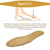 Vaya Exclusivo Primo Orthopaedic Insoles for Flatfoot Hallux Valgus with
