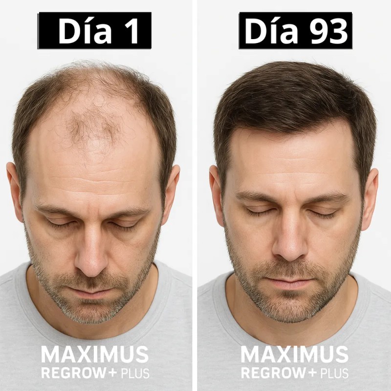 Tónico Maximus 20% Anticaída Para Crecer Barba Y Cabello