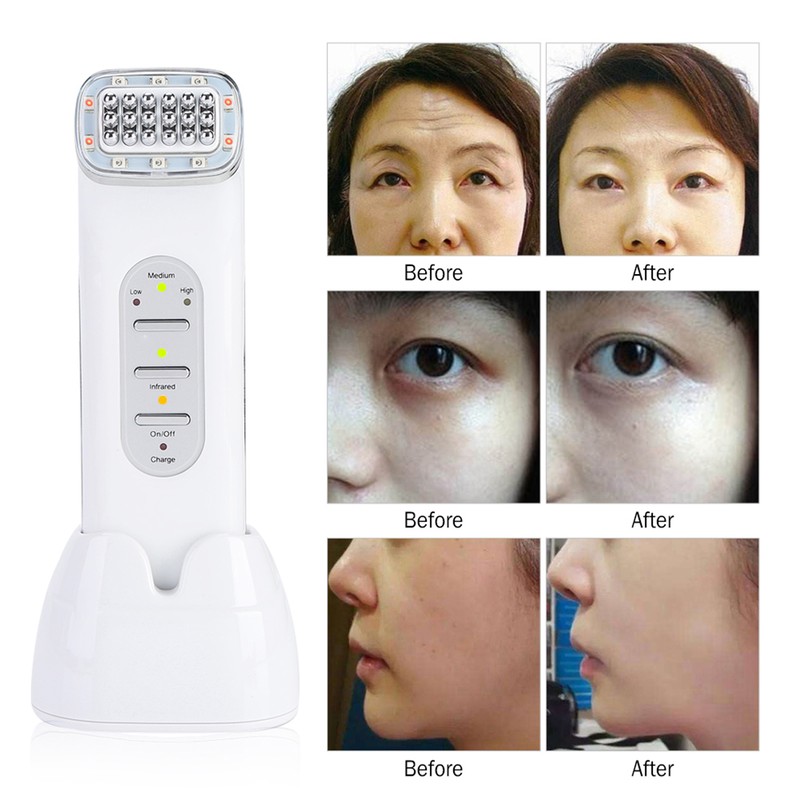 RF Radio Frequency Dot Matrix Face Tightening Rejuvenation Skin Beauty