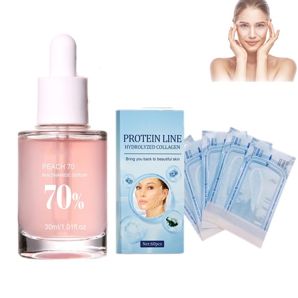 Mikabila (05) InstaLift Protein Thread Lifting Set, Collagen Silk Threads