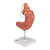 3B Scientific Human Anatomy - Stomach Band Model + Free