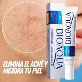 Tratamiento Acné Puntos Negros Manchas Cicatrices Barros Ful