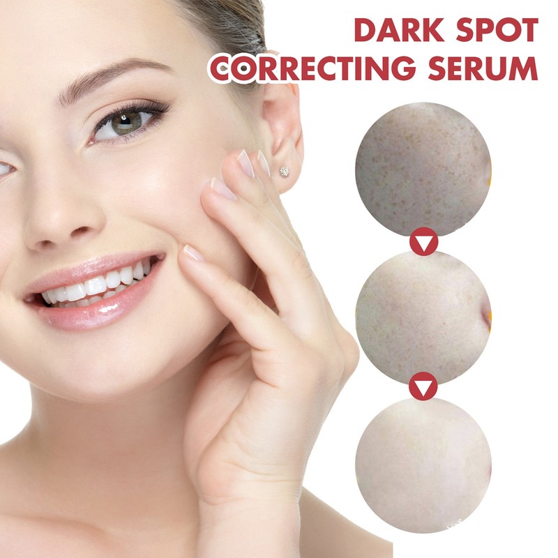 2pcs Dark Spot Correcting Serum with Niacinamide Hyperpigmentation Even Skin