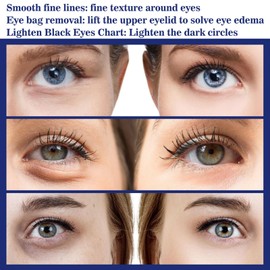 Retinol Eye Cream For Dark Circles,Night Care Reduces Eye Bags Blue,Anti Aging Eye Cream,Ey/e Cre/am For Dark Circles and Puffy Ey/e,Anti-Wrinkle Under Ey/e Cre/am,Eye Bags Remover,E/ye Care Products