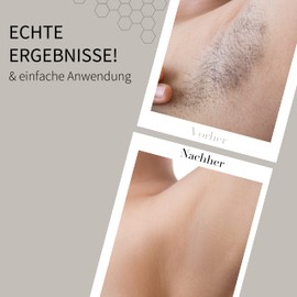 Fleeky Wax Roller Kit - Electric Roll-On Complete Set with Warm Wax Device for Silky Smooth Skin on Fleek, Professional Results and Beginner-Friendly Handling