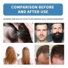 Mz Hace Crecer La Barba Y El Cabello, Original, 18