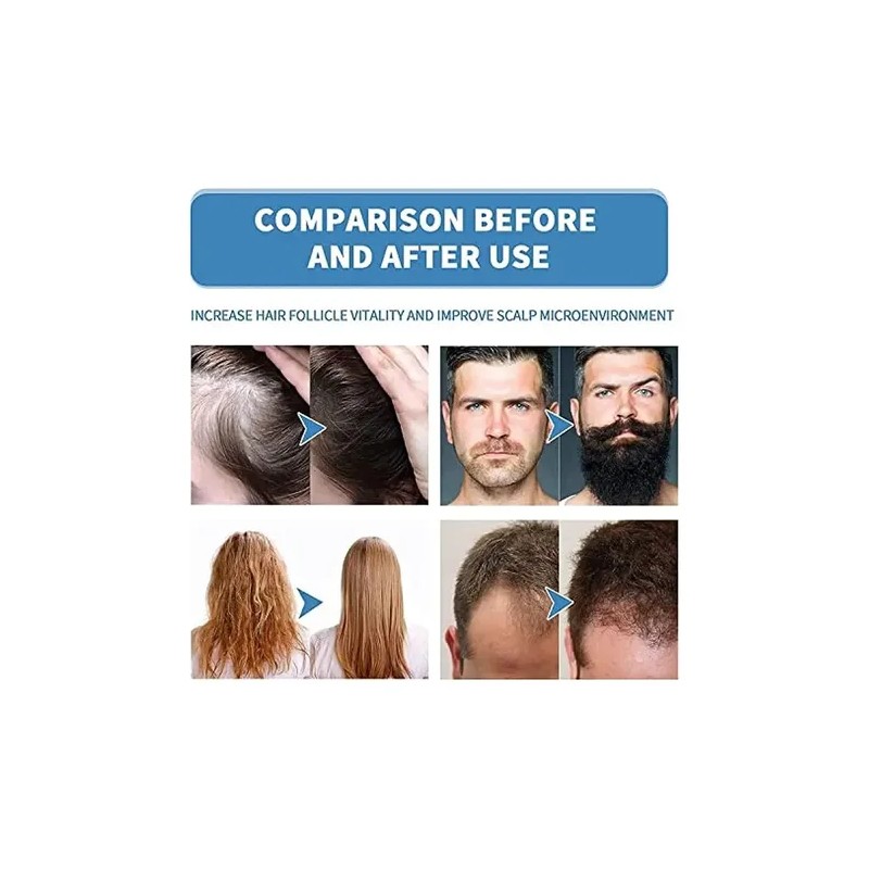 Mz Hace Crecer La Barba Y El Cabello, Original, 18