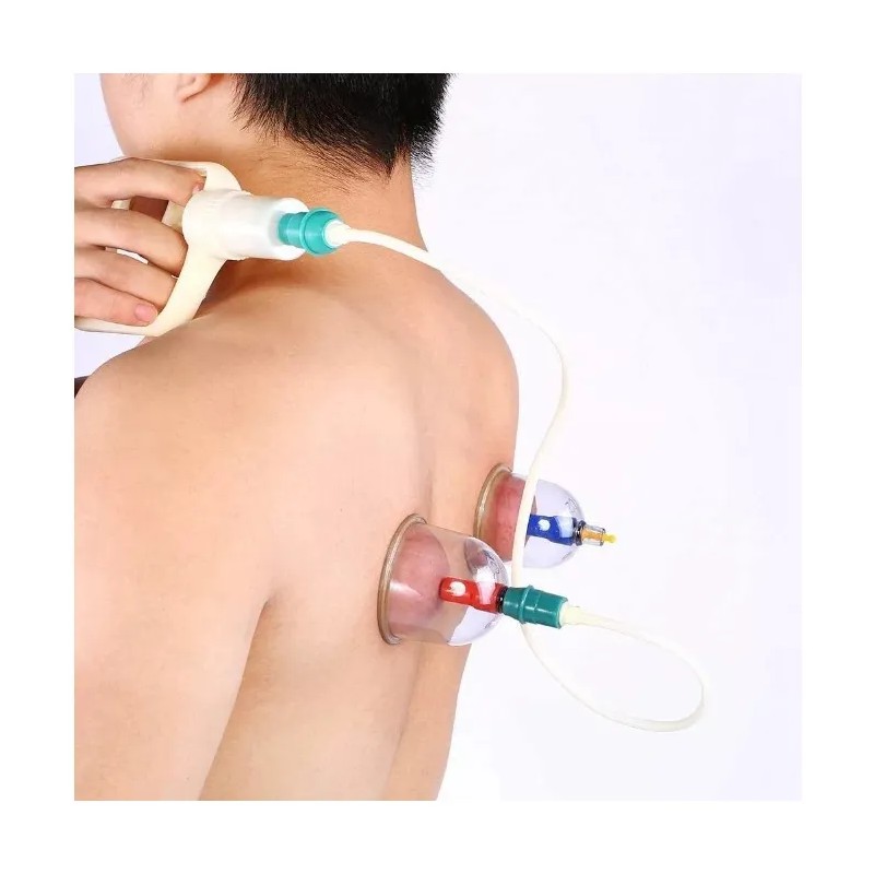 Kit 12 Ventosas Terapeuticas Masaje Succion Adelgazante