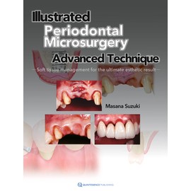 Illustrated Periodontal Microsurgery: Advanced Technique Soft Tissue Management for the Ultimate Esthetic Result