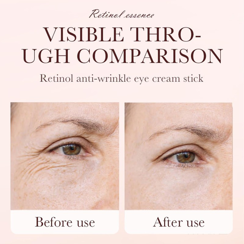Retinol Eye Stick y Crema Contorno de Ojos en Barra