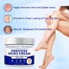 Varicose Veins Treatment for Legs- 2025 Varicose Vein Cream, Spider