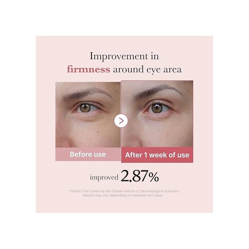 PDRN PINK PEPTIDE EYE SERUM 30ml