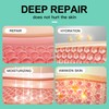 Large Silicone Scar Sheets 4 Pcs - 6" x 5"