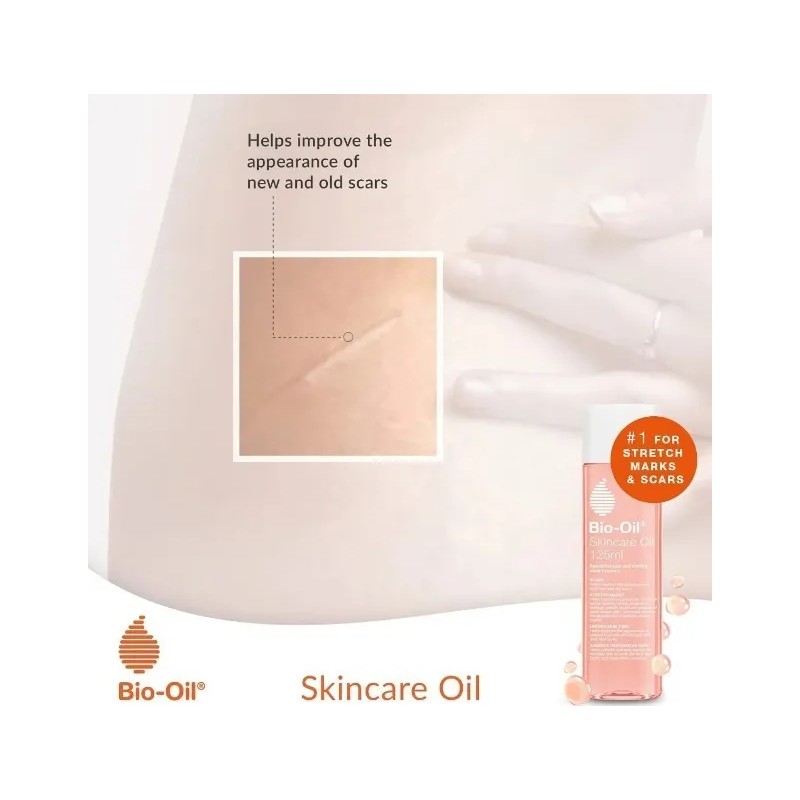 Aceite Corporal Bio Oil para Cicatrices y Estrías 125ml