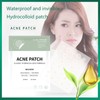 DWUENT Hydrocolloid Acne Patches Gift Box Set - 180 Invisible