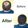 Cold pressed, castor oil 2 packs, eyelash nutrition hair growth