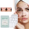 396Pcs Blemish Patches Facial Pimple Zit Spot Stickers Mild Non