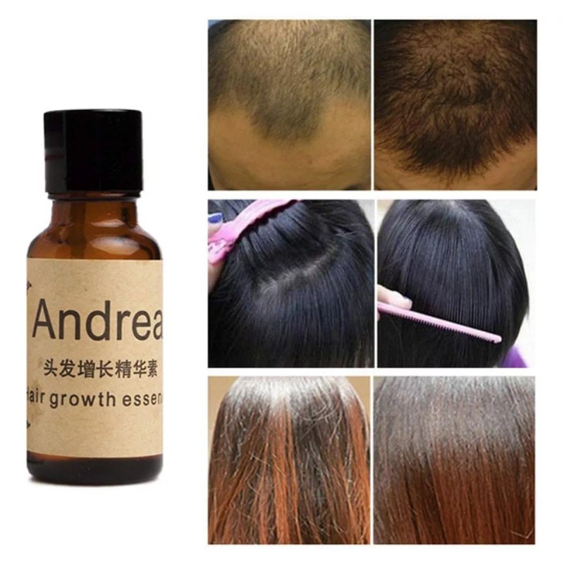 Andrea Paquete 5pza Andrea Solución Crecimiento Del Cabello Full