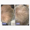 Scandinavian Biolabs Bio-Pilixin Activation Serum 100ml for Hair Loss for