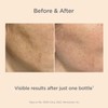 ISDIN Ceutics Melaclear Advanced - Corrector De Manchas Oscuras Para