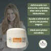 Crema Antiacné Con Cúrcuma 4 Oz - Caléndula Y Aloe