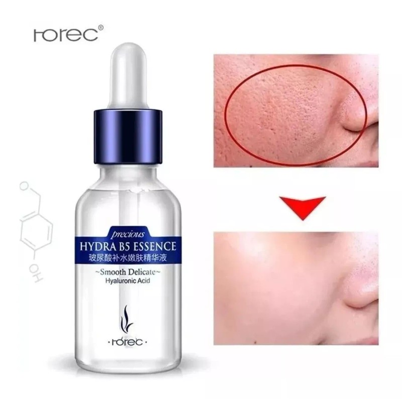 ACIHIAUP-876 Acido Hialuronico Puro Concentrado B5 Esssence Anti Arrugas