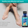 *sérum Fortalecedor De Uñas, Tratamiento Nutritivo Y Reparad