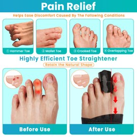 Hammer Toe Straightener Corrector for Women & Men - Toe Splint Relief for Hammer Toe, Crooked Toe, Curled Toe, Broken Toe Support (1 Compression Foot Wrap & 1 Toe Strap)