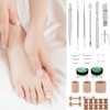 QWORK® Ingrown Toenail Correction Set 104 Pieces