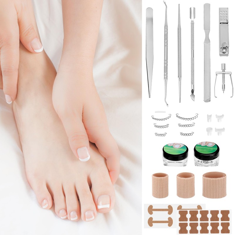 QWORK® Ingrown Toenail Correction Set 104 Pieces