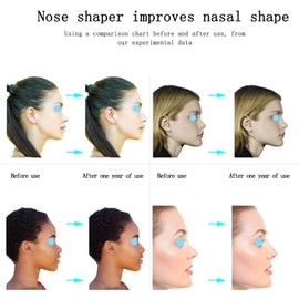 jieri Nose Shaper Lifter Clip, Nose Slimmer Nose Discs Reshape Nose, Nose Shaper for Wide Nose Lifter Straightener for Men/Women
