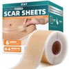 Silicone Scar Sheets, Silicone Scar Tape for Surgical Scars -