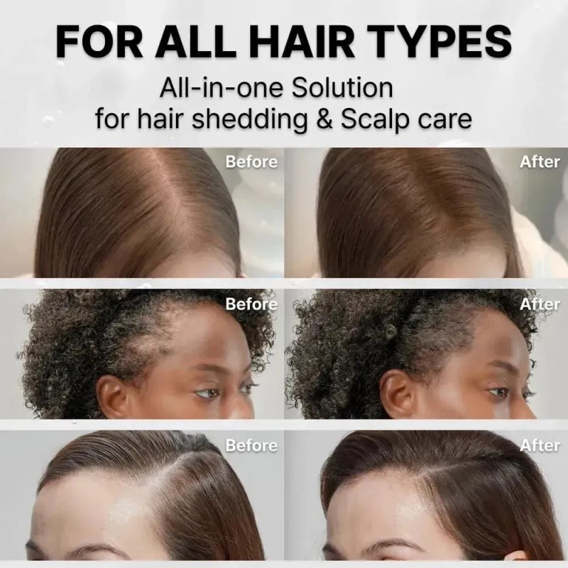 Lilyeve Hair Growth Serum With Brush