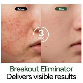 Ivoskin Crema Coreana Reparadora Intensiva De Cica Acn Sensible Danoche                                                                               