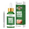 Líquido Reparador De Esmalte Líquido U Nail Repair Líquido N